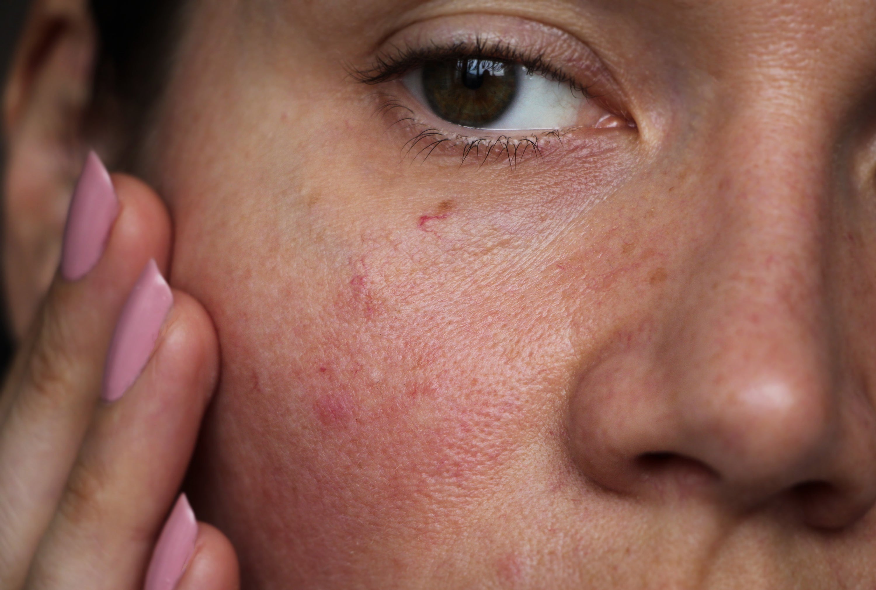 Cytogen Masque: Supporting Skin Through Inflammation and Recovery
