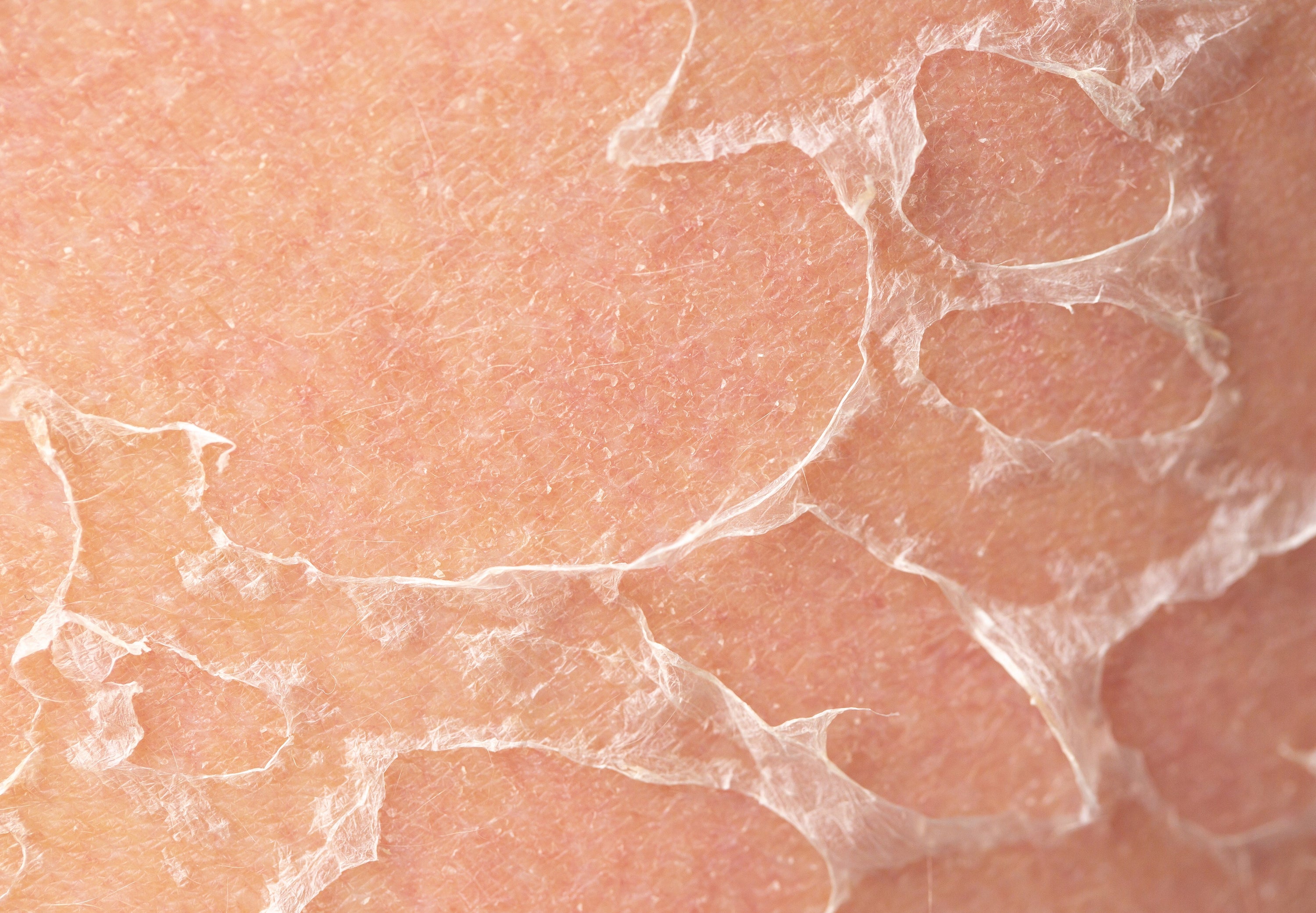 Biosignaling 101: How Skin Heals Through Communication