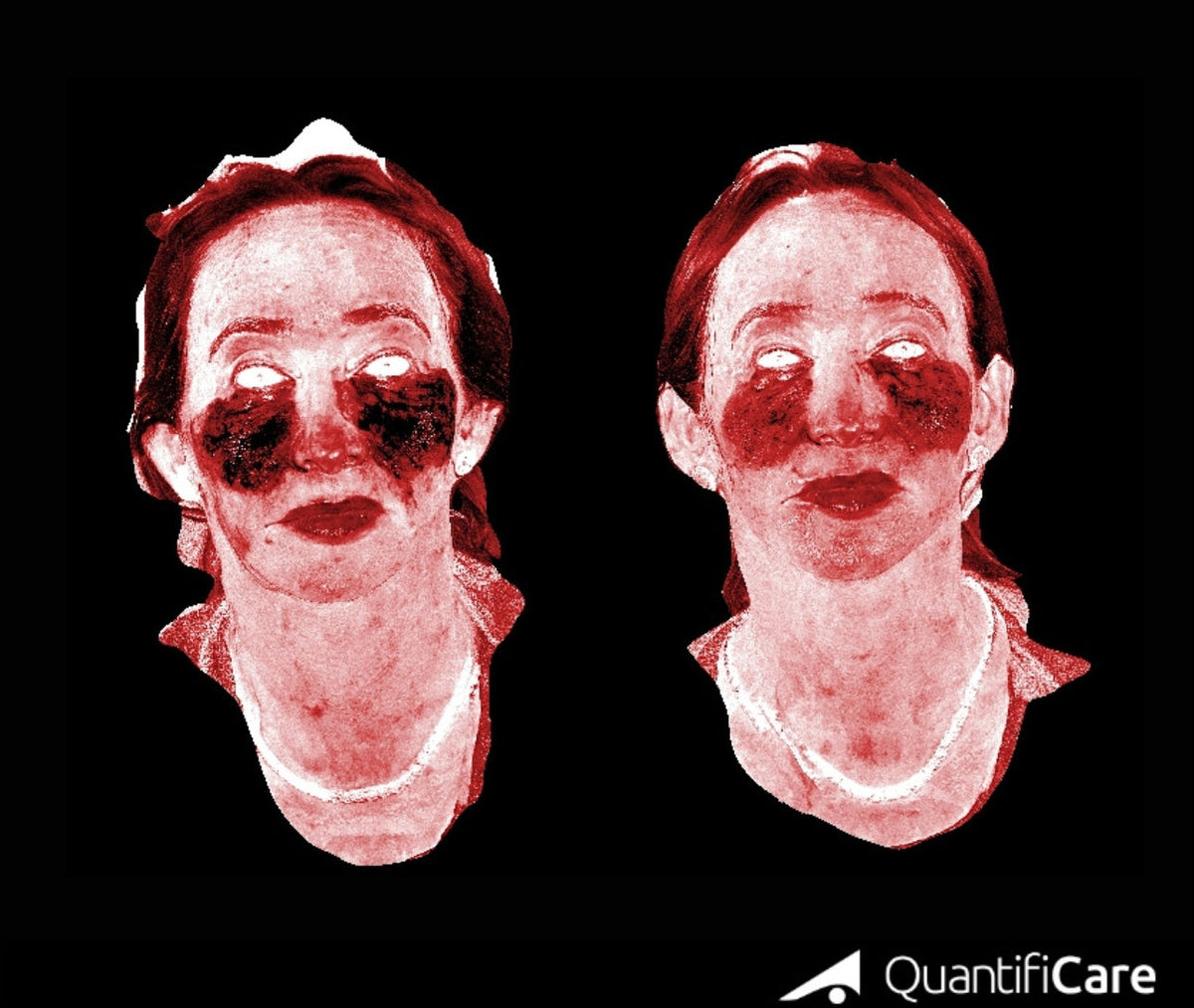 Cytogen Masque | Providers – Bionassay